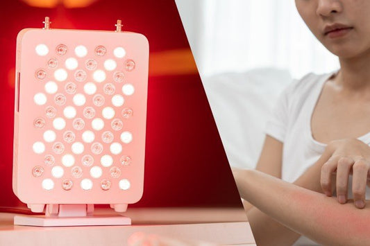 Rood licht therapie bij zonbeschadiging: wat doet het voor de huid? - Liroma