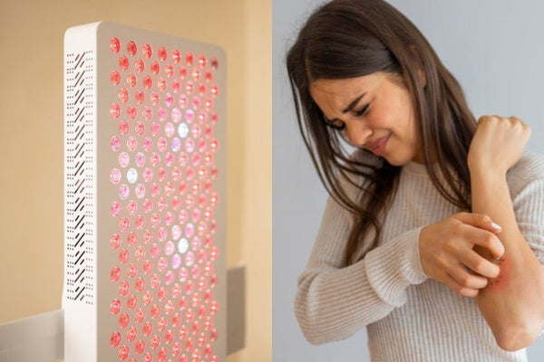 Rood licht therapie en eczeem: Hoe werkt het? - Liroma